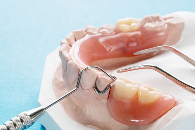 Pełny uśmiech dzięki nowoczesnym protezom zębowym – innowacje w protetyce stomatologicznej